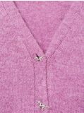 Rozpinany sweter - różowy - SINSAY - small5